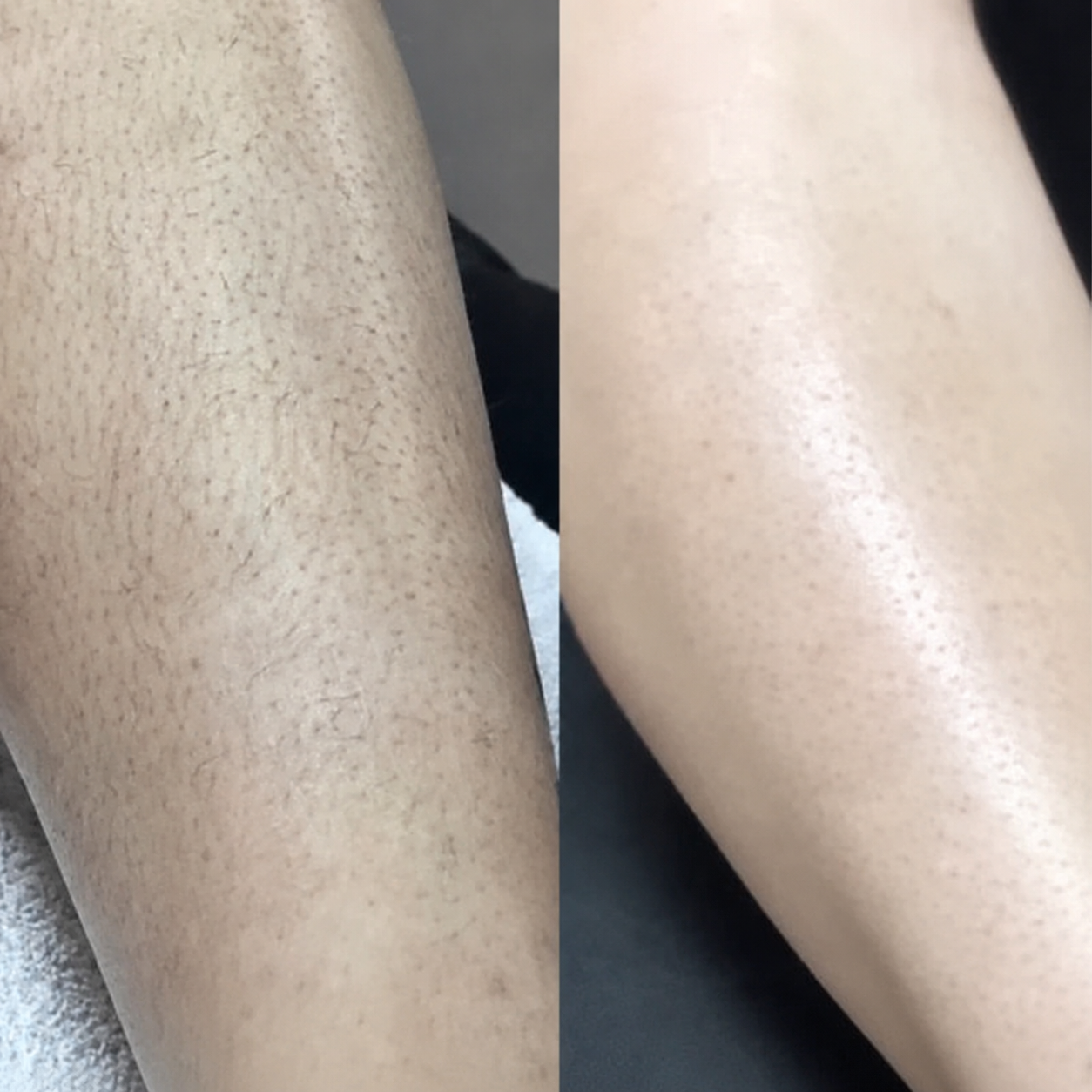 SILK SKIN™ Rasuradora Femenina
